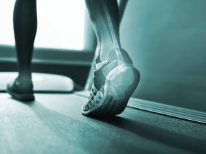 Fisioterapia na Análise e Reeducação Funcional do Movimento